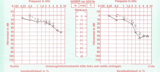 HiFi-Ohren