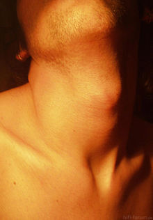 220px Male Neck