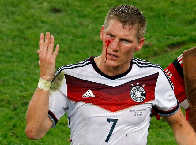 Schweini 1