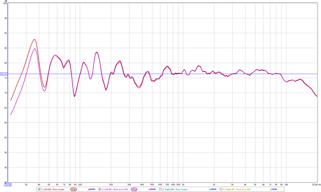 Left Br   Pure Audio + Atm