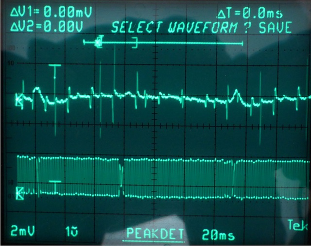 Marantz CD73 KO-Signal (Spindelmotor Strom/HF-Signal) Von Tonausfällen Laufwerk CDM-0