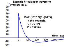 Friedlander Waveform