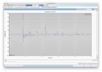 LZ mit Dirac